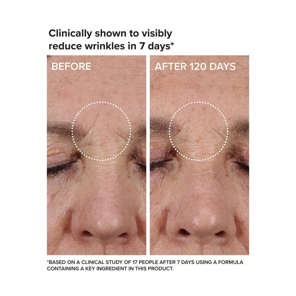 Needle-Less Growth Factor Serum