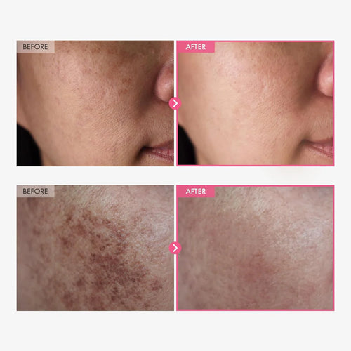 Korean Advanced Arbutin Brightening Cream